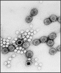 20110306-rotavirus cdc   disease_rotavirus3.jpg